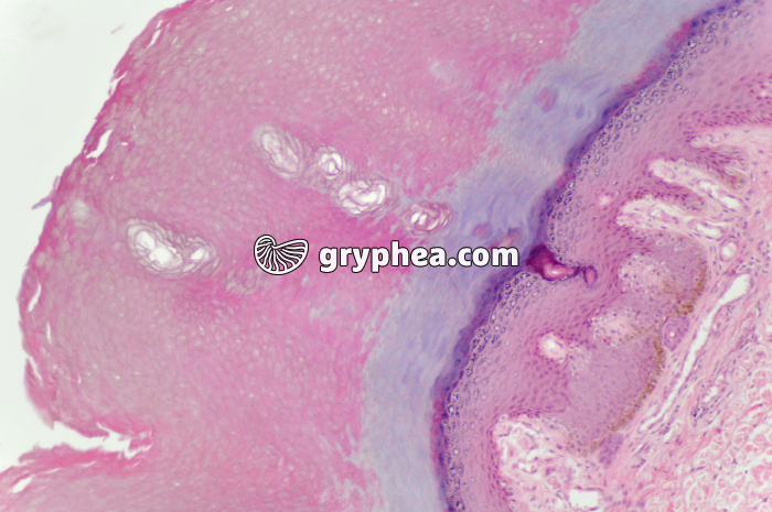 Peau avec glandes sudoripares x40 - gryphea.com